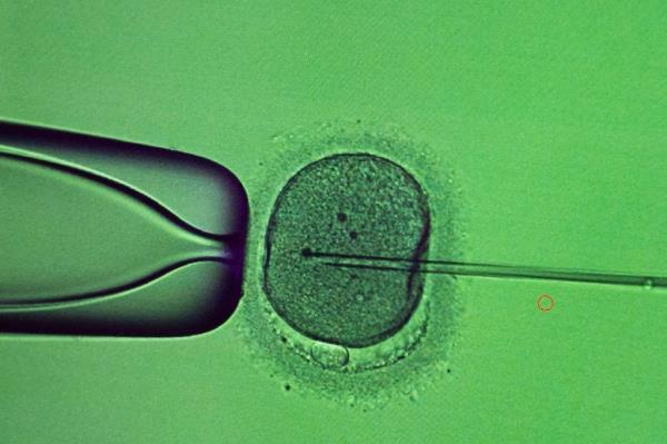 A doctor co<em></em>nducts the procedure of intracytoplasmic sperm injection (ICSI) at the laboratory of the IVMED fertility clinic in Kyiv, Ukraine,